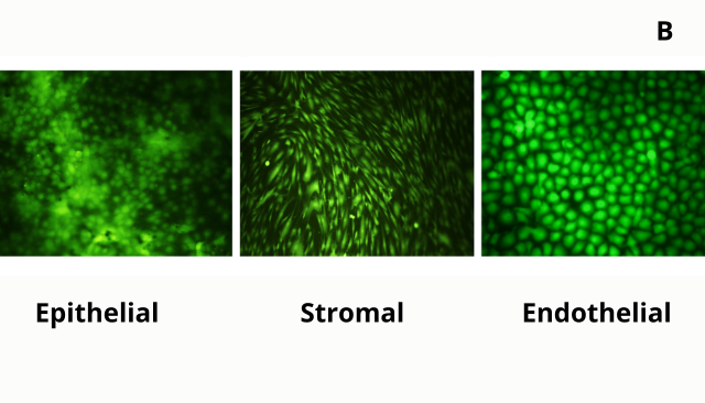 Three images showing staining pattern of epithelial, stromal and endothelial cells